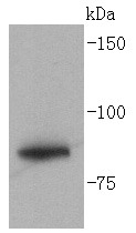 Anti-GYS1 Antibody (7U169)