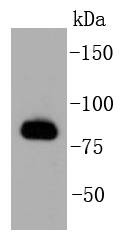 Anti-GRK2 Antibody (8P72)