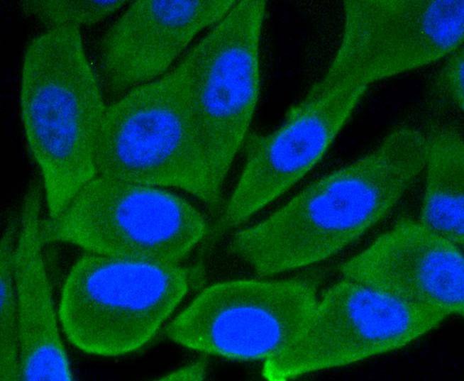 Anti-GSK3B Antibody (1A830)