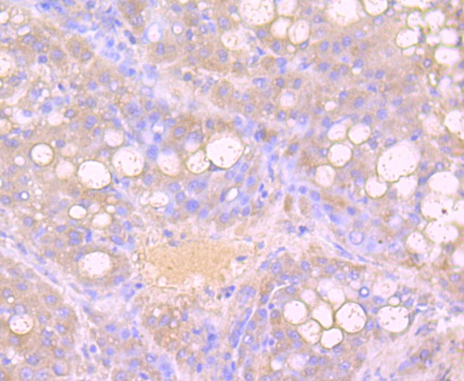 Anti-Growth Hormone Antibody (1Z775)