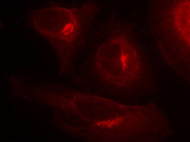 Anti-Phospho-GSK3A (Ser21) Polyclonal Antibody