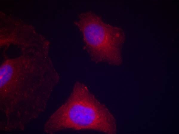 Anti-Phospho-GSK3A/B (Tyr279, 216) Polyclonal Antibody