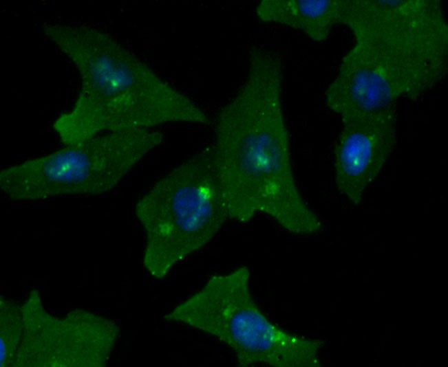 Anti-GOLM1 Antibody (8V618)