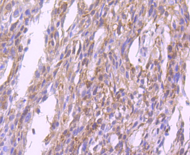 Anti-GPX1 Antibody (4U620)