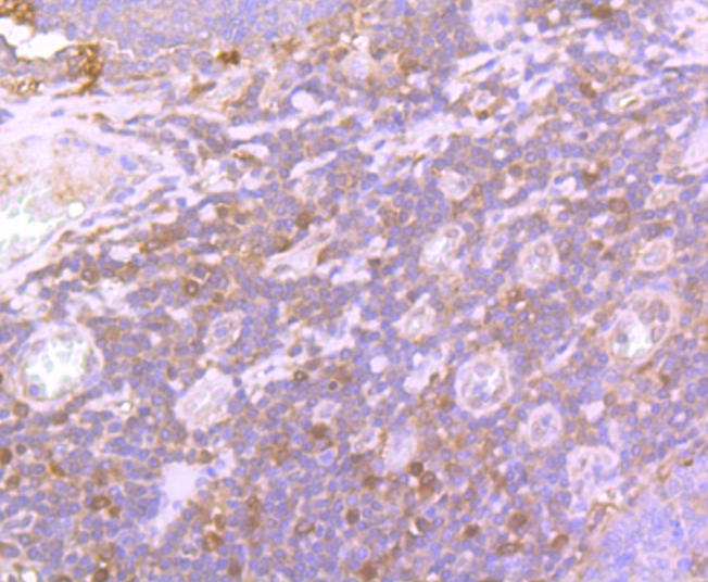 Anti-GPX1 Antibody (4U620)
