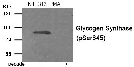 Anti-Phospho-GYS1 (Ser645) Polyclonal Antibody