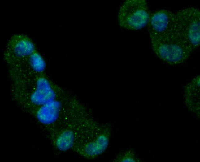 Anti-GYS1 Antibody (7U169)