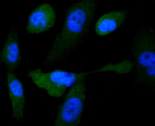Anti-GYS1 Antibody (7U169)