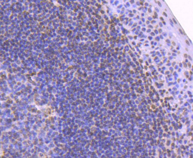 Anti-Histone H2B type 1-K Antibody (4Z139)