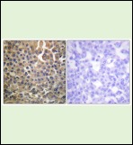 Anti-Phospho-HER4/ERBB4 (Tyr1284) Polyclonal Antibody