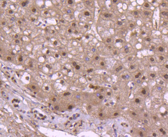 Anti-Histone H2B type 1-K Antibody (4Z139)