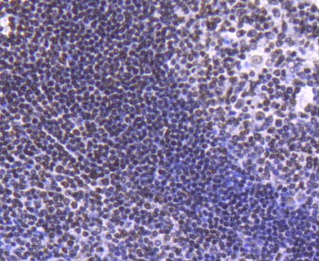 Anti-Acetyl-Histone H2B type 1-K (Lys20) Antibody (5U443)