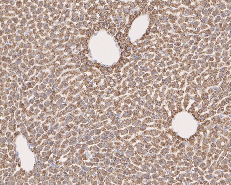 Anti-HADHSC Antibody (1K241)