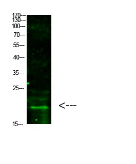 Anti-Tri-methyl-HIST1H3A (Lys5) Polyclonal Antibody