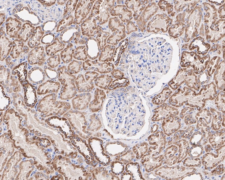 Anti-HADHSC Antibody (1K241)