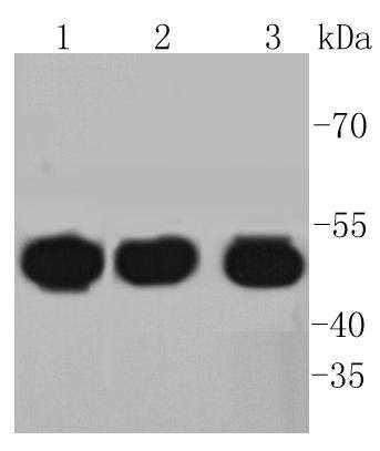 Anti-HAPLN1 Antibody (1R32)