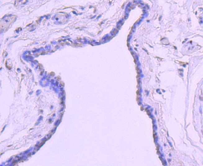 Anti-Mono-methyl-Histone H2B type 1-K (Arg79) Antibody (5Q957)