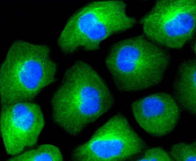 Anti-HAPLN1 Antibody (1R32)