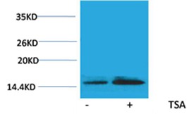Anti-Acetyl-Histone H2B type 1-B (Lys15) Polyclonal Antibody