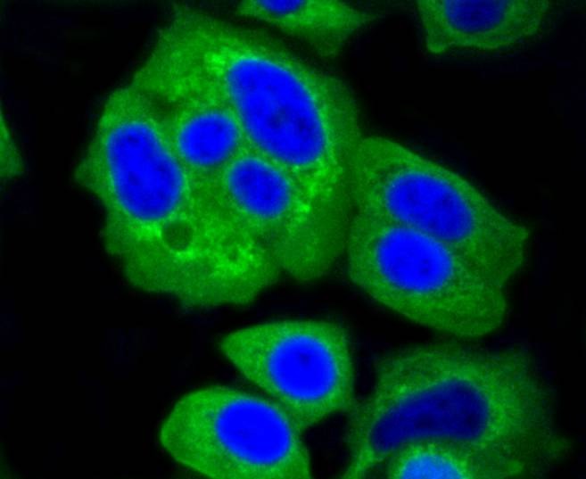 Anti-HK1 Antibody (7G677)