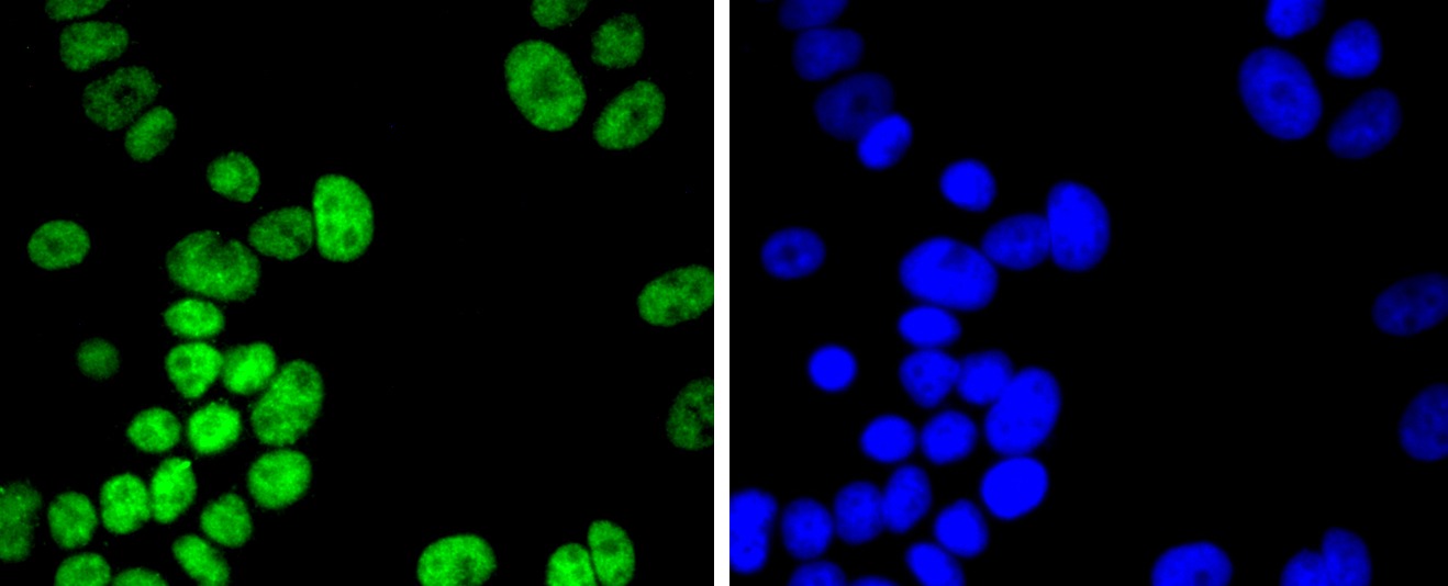Anti-Acetyl-Histone H2B type 1-K (Lys20) Antibody (5U443)