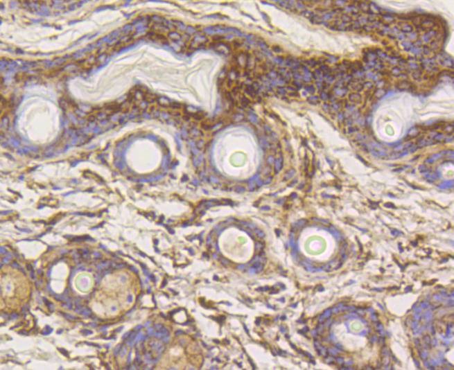 Anti-HK1 Antibody (7G677)
