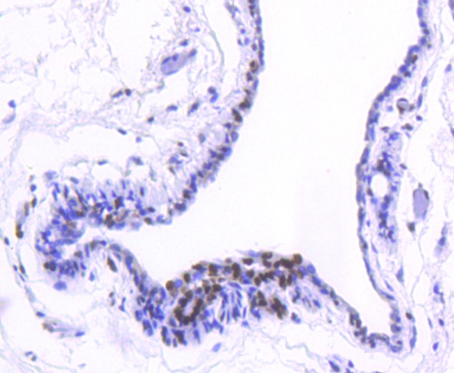 Anti-Acetyl-Histone H2B type 1-K (Lys20) Antibody (5U443)