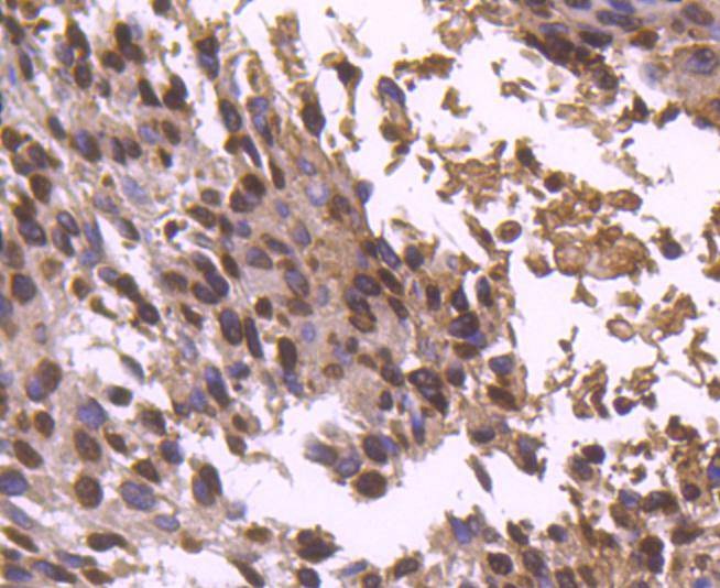 Anti-Histone H2B type 1-K Antibody (4Z139)