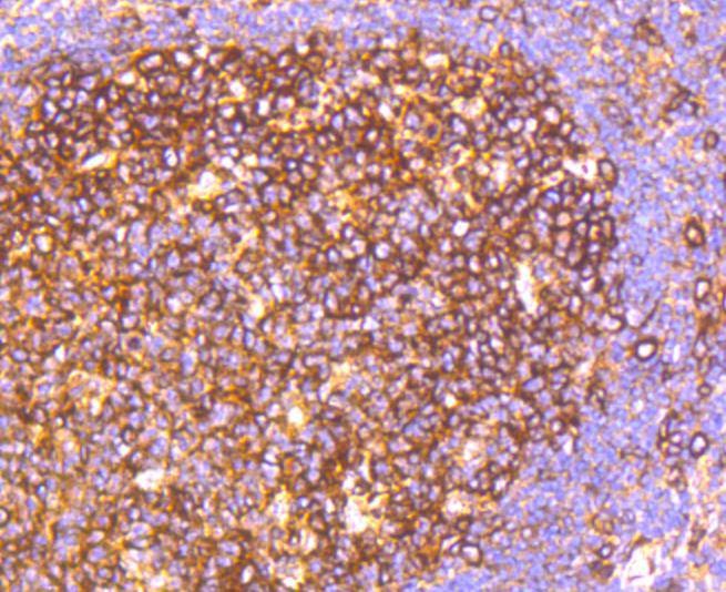 Anti-HAPLN1 Antibody (1R32)