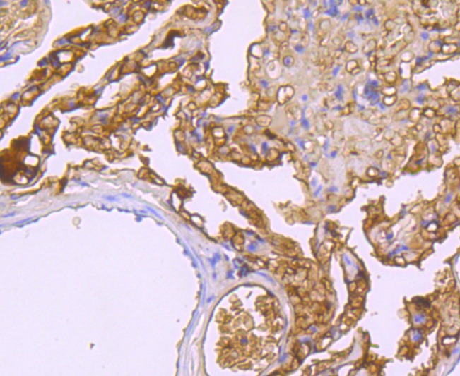 Anti-Haptoglobin Antibody (8N175)
