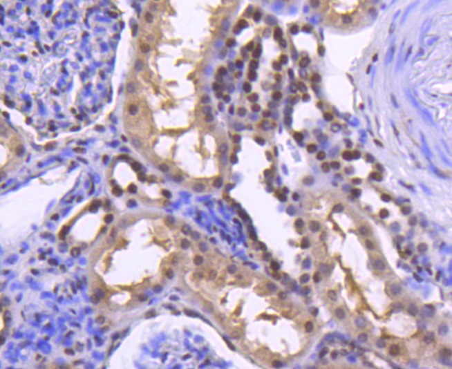 Anti-Acetyl-Histone H2B type 1-K (Lys20) Antibody (5U443)