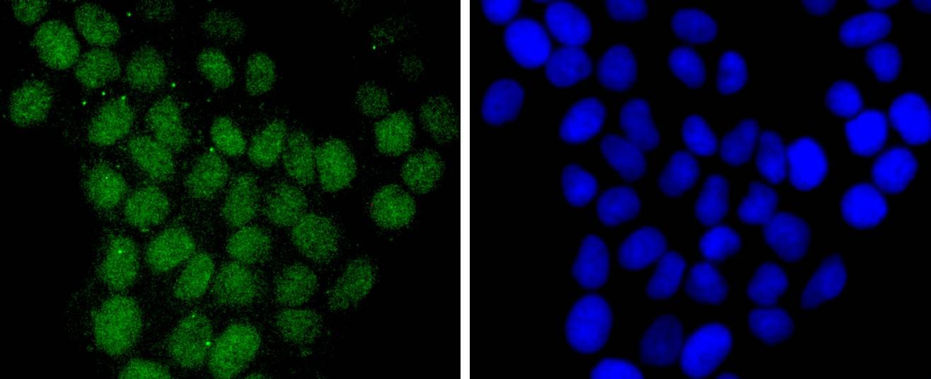 Anti-Mono-methyl-Histone H2B type 1-K (Arg79) Antibody (5Q957)