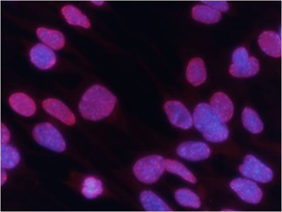 Anti-Tri-methyl-HIST1H3A (Lys27) Polyclonal Antibody