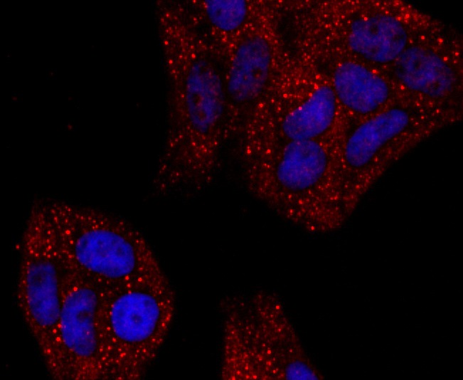 Anti-Haptoglobin Antibody (8N175)