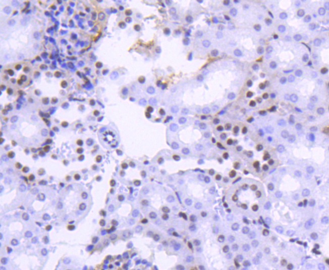 Anti-Acetyl-Histone H2B type 1-K (Lys20) Antibody (5U443)