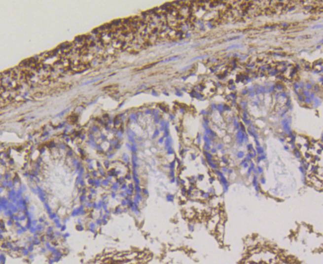 Anti-HK1 Antibody (7G677)