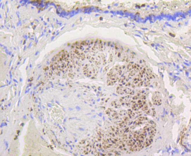 Anti-HK1 Antibody (7G677)