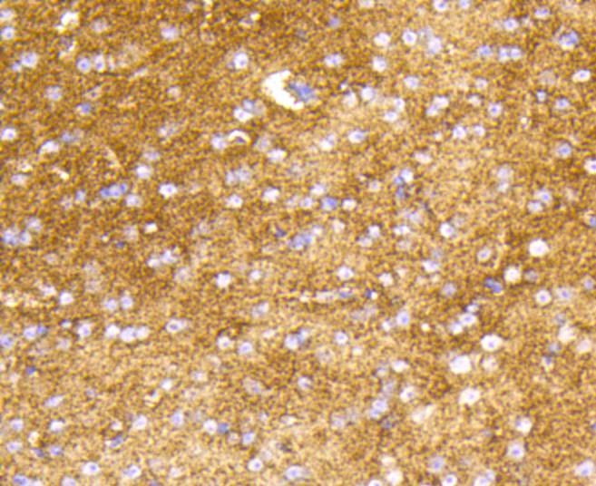 Anti-HK1 Antibody (7G677)