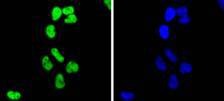 Anti-Acetyl-Histone H2B type 1-K (Lys20) Antibody (5U443)