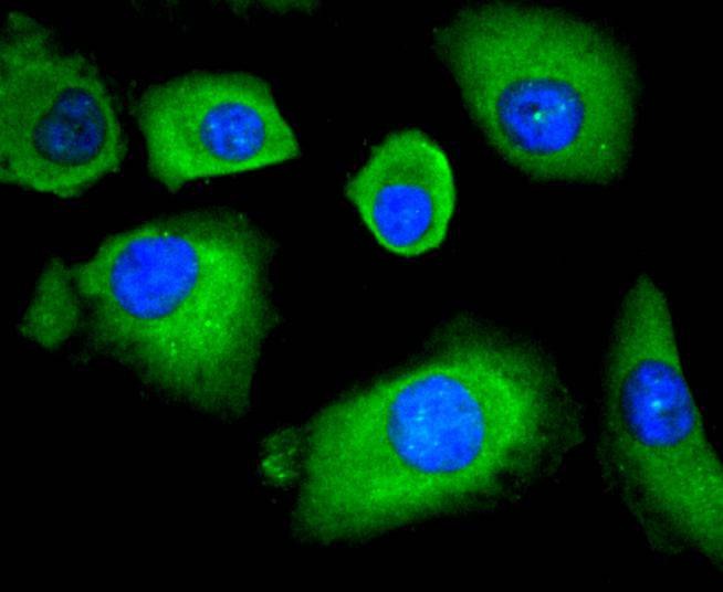 Anti-HDAC4 Antibody (5T743)
