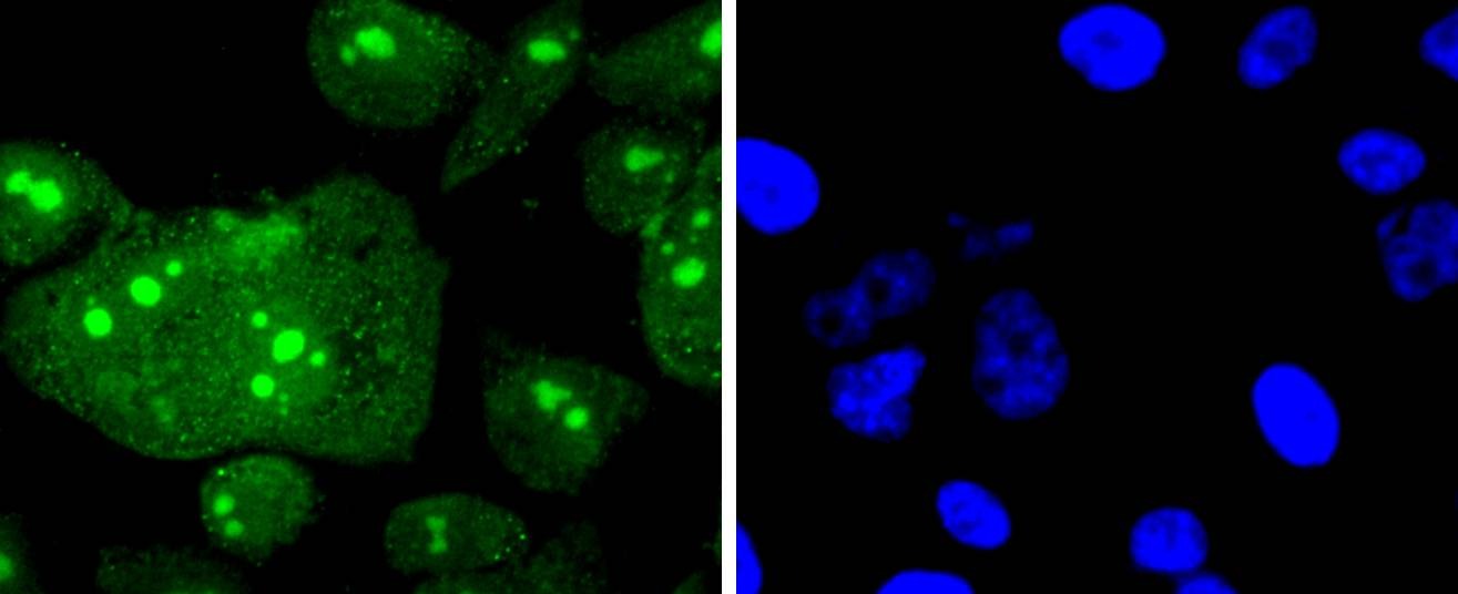 Anti-Mono-methyl-HIST1H3A (Arg2) Antibody (9C212)