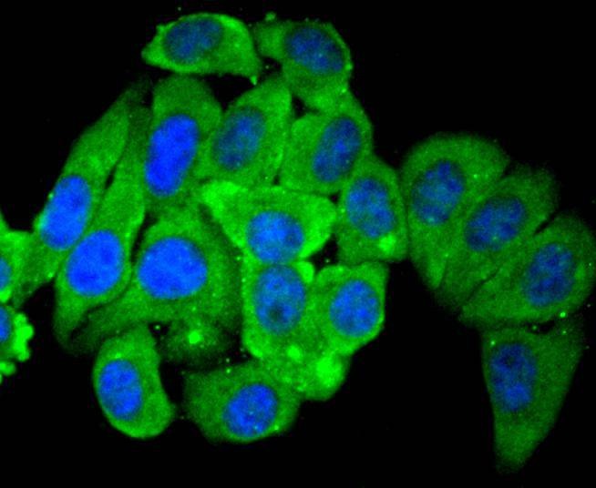 Anti-HDAC4 Antibody (5T743)
