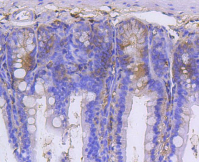 Anti-GARS Antibody (2F92)