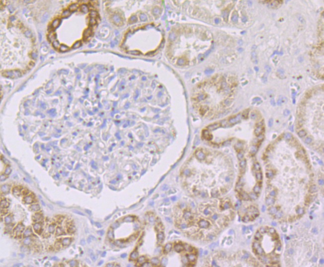 Anti-GRIM19 Antibody (2M560)