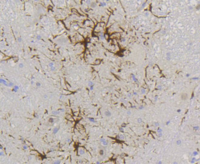 Anti-GFAP Antibody (7W409)