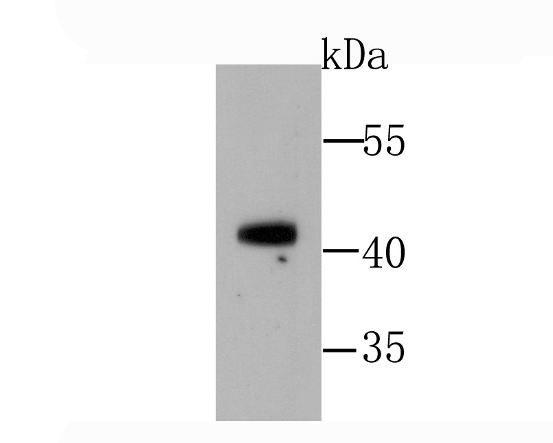 Anti-GATA1 Antibody (4D22)