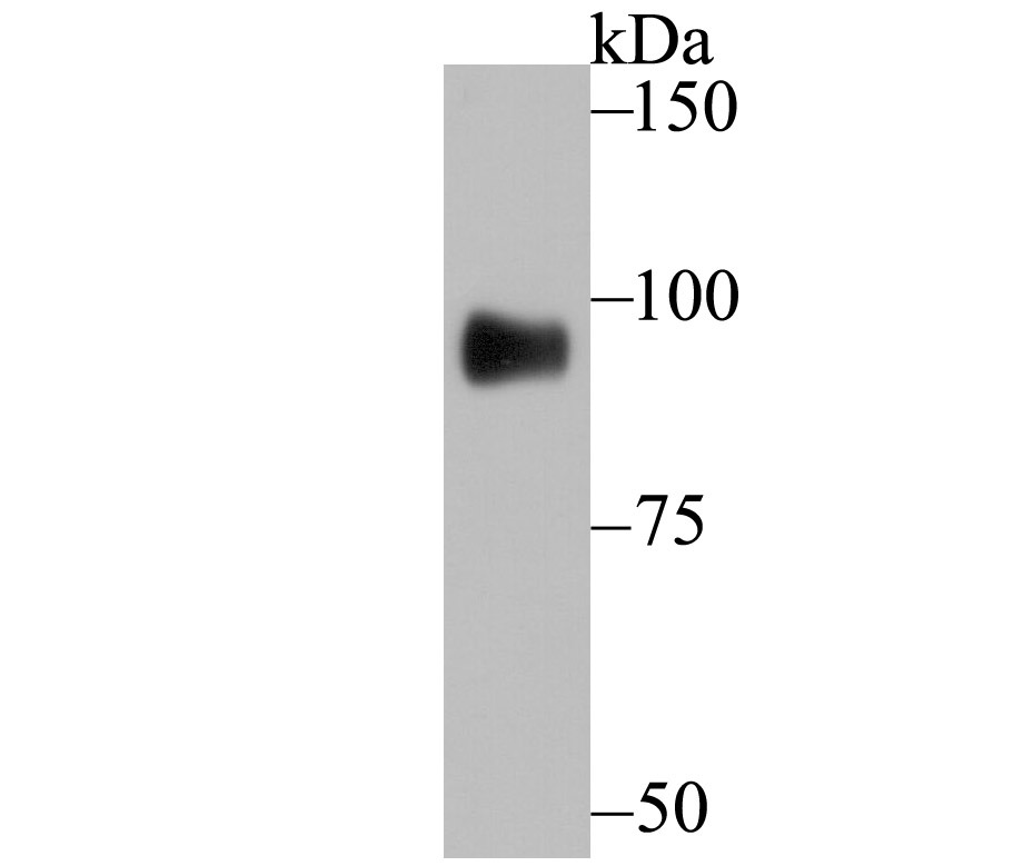 Anti-GIT1 Antibody (6A39)