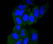 Anti-GART Antibody (9K216)