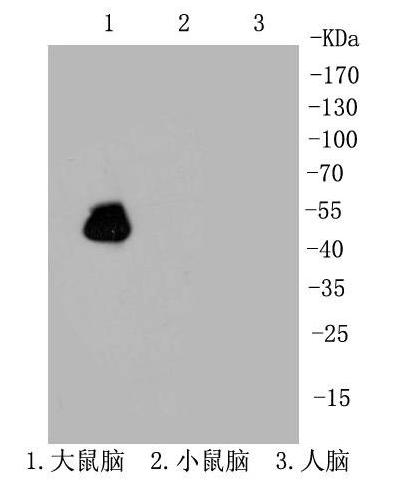 Anti-GFAP Antibody (7W409)