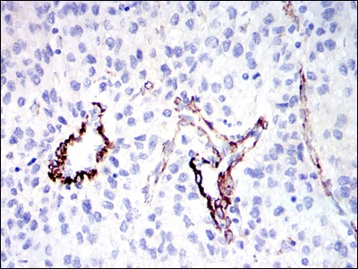 Anti-GKAP Antibody (3C392)